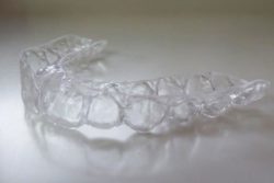 Appareil dentaire de contention - Strasbourg