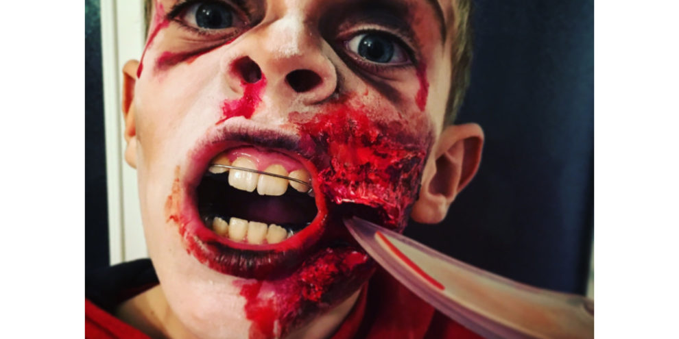 ORTHODONTIE STRASBOURG GAGNANT HALLOWEEN.001